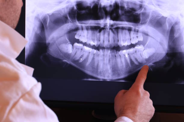 Best Cosmetic Emergency Dentistry in Port Morris, NJ